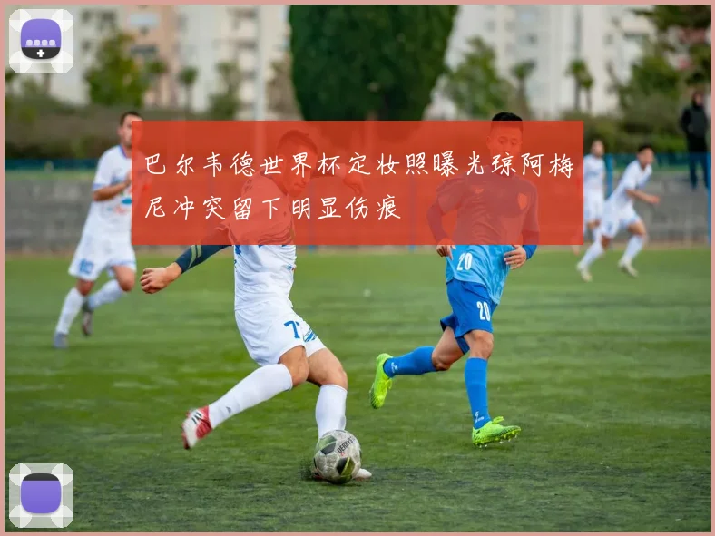 巴尔韦德世界杯定妆照曝光琼阿梅尼冲突留下明显伤痕